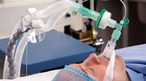 جهاز تنفس صناعي